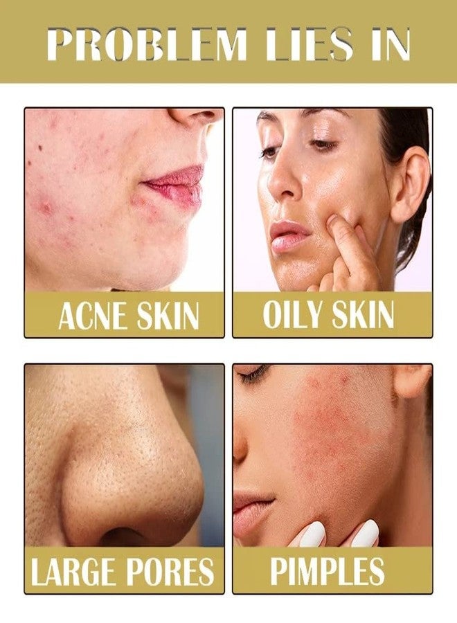 Grospe Retinol Snake Venom Peptide Gold Mask Anti-aging Clear and Moisturizing Improving Rough Skin Peeling Mask, Tightening Moisturizing Toning and Nourishing The Skin (3PCS) - Image 3